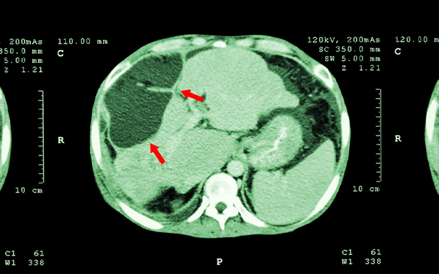 Clinician reviewing patient imaging data on screen in a research setting